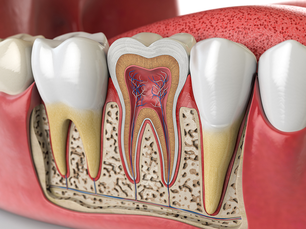 Why Do I Need a Root Canal?