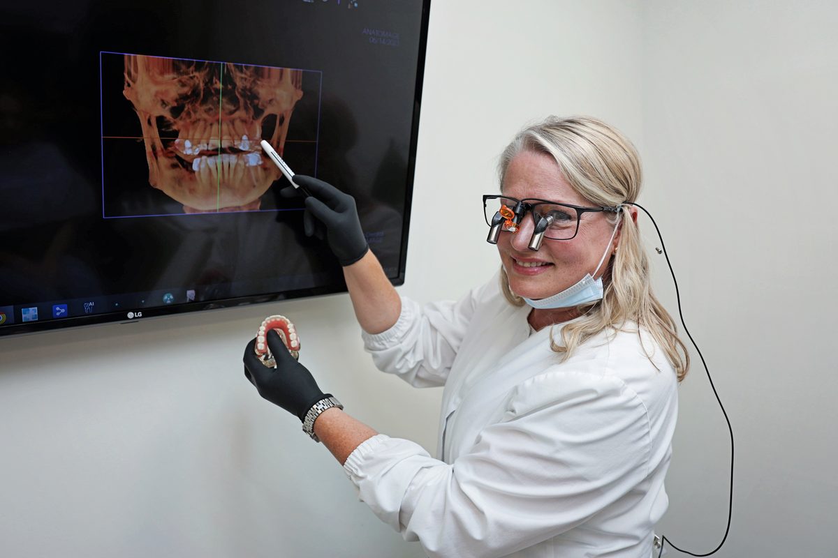 Dental Implants