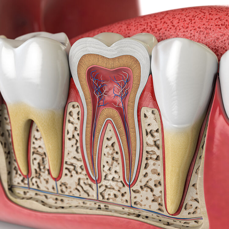 Why Do I Need a Root Canal?